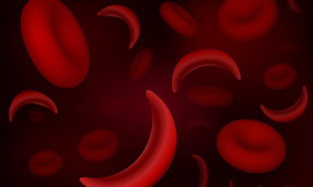 FDA Advisors Say New Gene Therapy for Sickle Cell Disease Is Safe