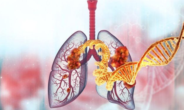 Study Identifies Familial Germline EGFR T790M Variant in Lung Cancer
