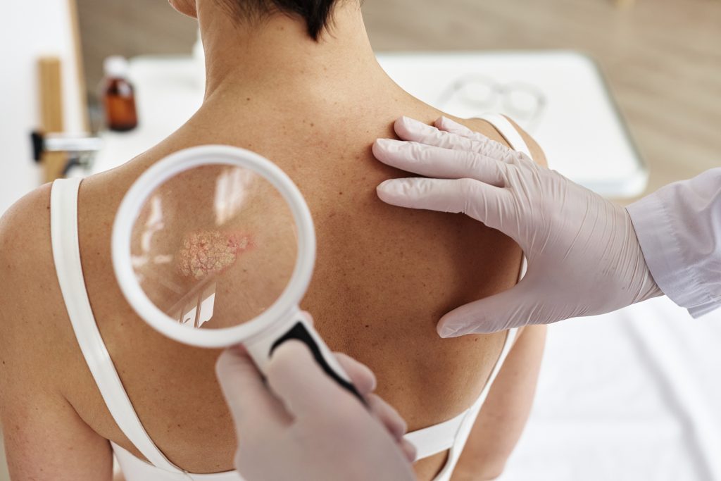 Doctor examining skin of Woman, Psoriasis, eczema, illustration, dermatology