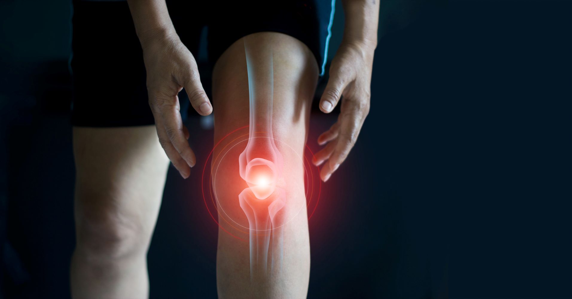 Visuospatial Perception Bias in Patients with Painful Knee Osteoarthritis
