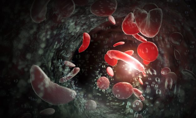 First Gene-Editing Therapies for Sickle Cell Disease Approved by FDA