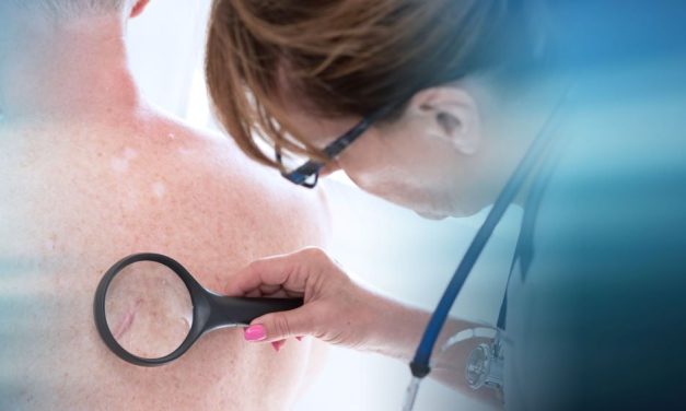 Efficacy Shown for New Melanoma Therapeutic Vaccine