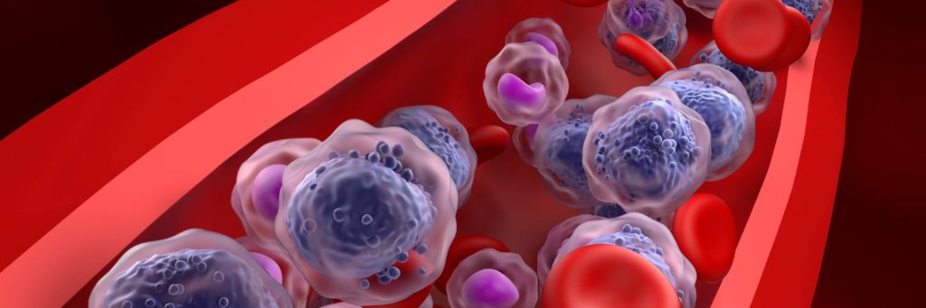 Acute myeloid leukemia AML cells in blood flow, closeup view, oncology, hematology. 3d illustration