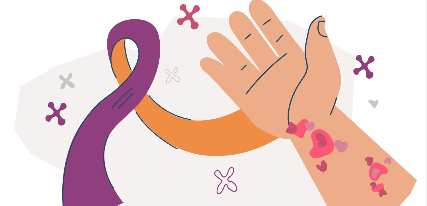 Psoriasis awareness campaign orchid purple orange ribbon on doctor's hand, dermatology, photo