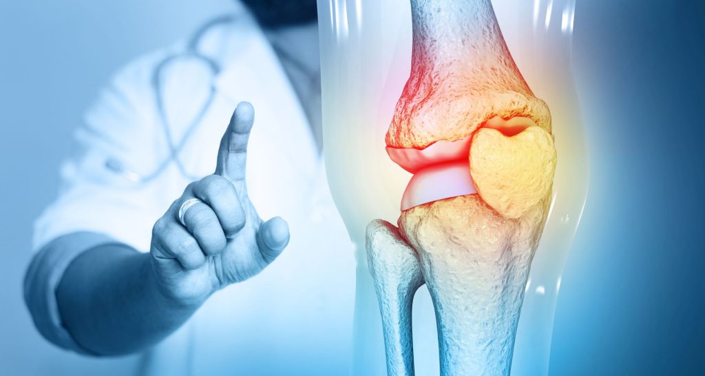 Doctor checking knee joint on medical background, osteoarthritis, rheumatology, graphic image