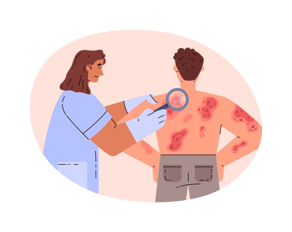 Doctor examining male patient with skin rash, psoriasis, eczema, dermatology. Vector illustration