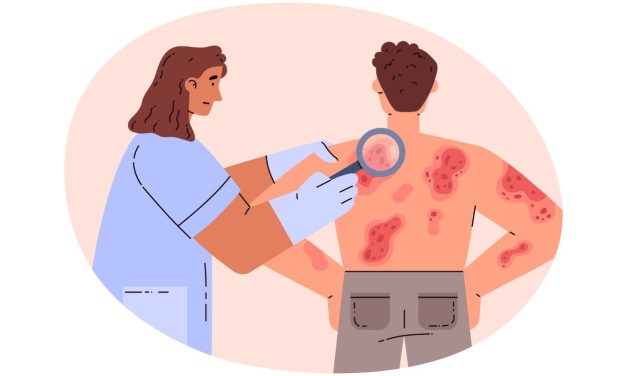 Psoriasis Severity: Real-World Patient-Reported Outcomes