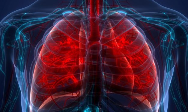 Preserving Pulmonary Function’s Clinical Impact Following Lung Resection in Early-Stage NSCLC