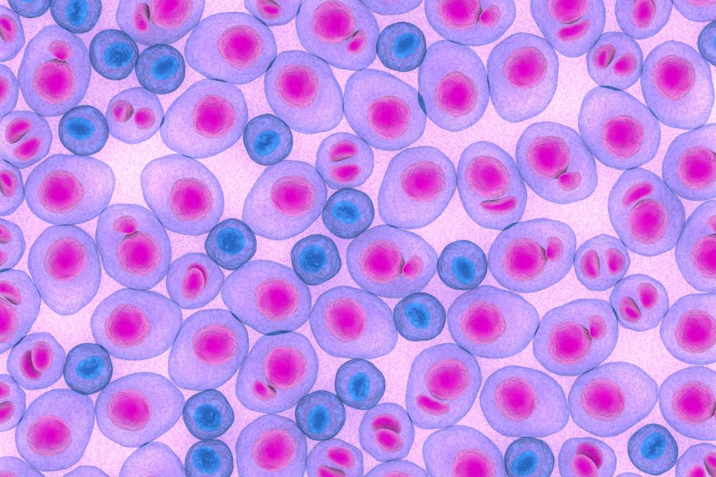 Myeloma multiplex leukemia cancer, multiple myeloma, t-cell, bone marrow, amyloid, oncology, 3d illustration