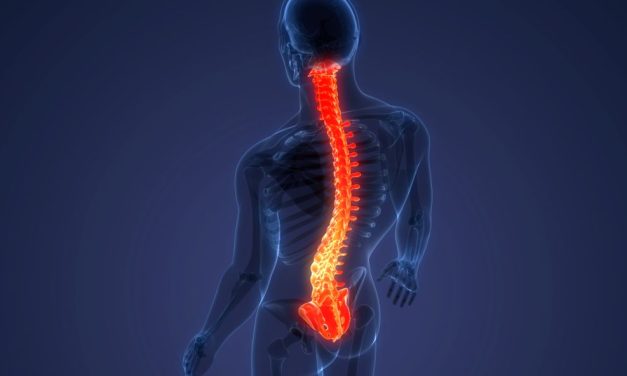 MS Research Supports Long-Term Targeting of Spinal Cord Demyelination