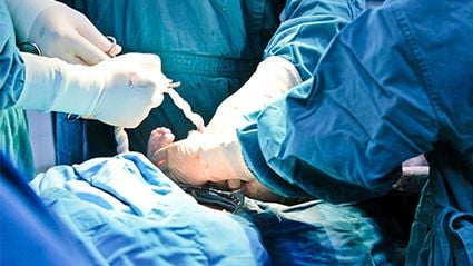 Racial Disparities Persist in General Anesthesia Rates for C-Section