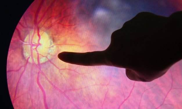 Diabetic Retinopathy Predict CVD in Patients With T1D
