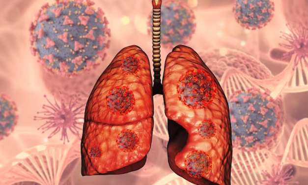ECOG Performance Status Linked With Survival in NSCLC