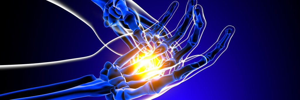 hand joint pain, RA, rheumatoid arthritis, rheumatology, illustration