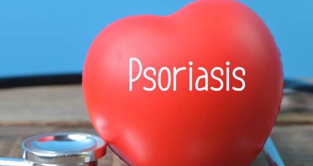 Physicians Should Screen Patients With Psoriasis for Cardiovascular Risk Factors