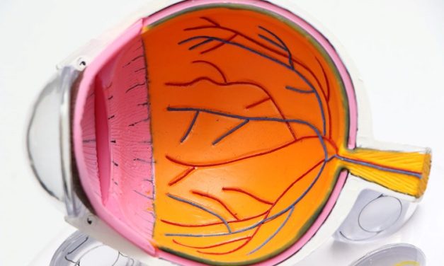 Most Adults With AMD Unaware of Diagnosis