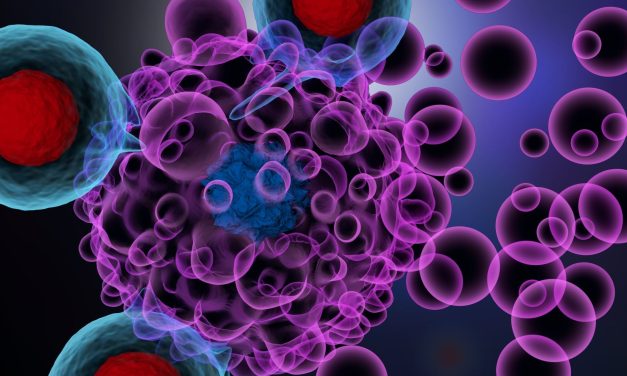 Tabelecleucel Shows Promise as Therapeutic Option for EBV-Related Post-Transplant Lymphoproliferative Disease