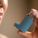 BT in Severe Asthma