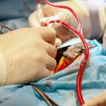coronary bypass surgery, heart valve, cardiology, surgery, photo