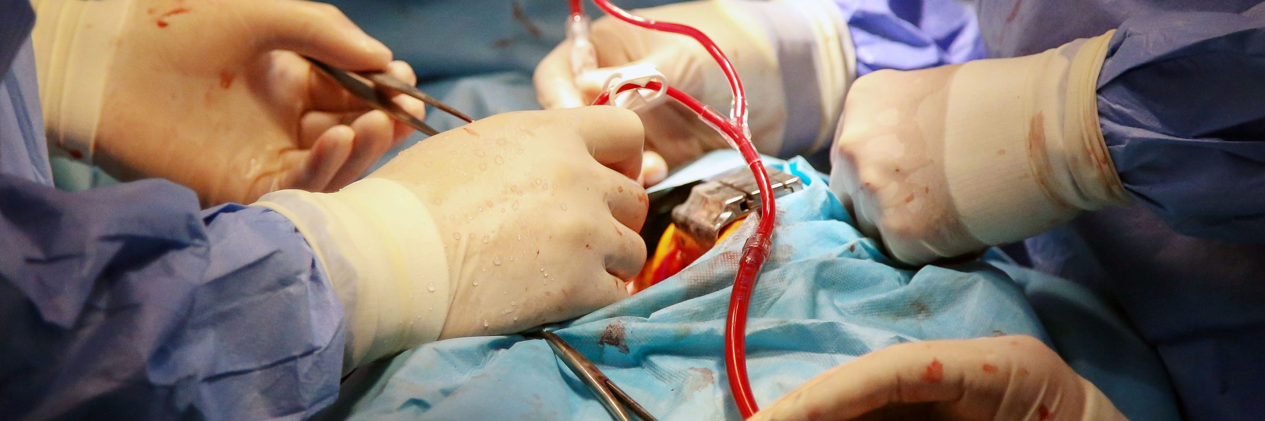 Safety of TAVI Noninferior to SAVR for Patients With Lower Surgical Risk