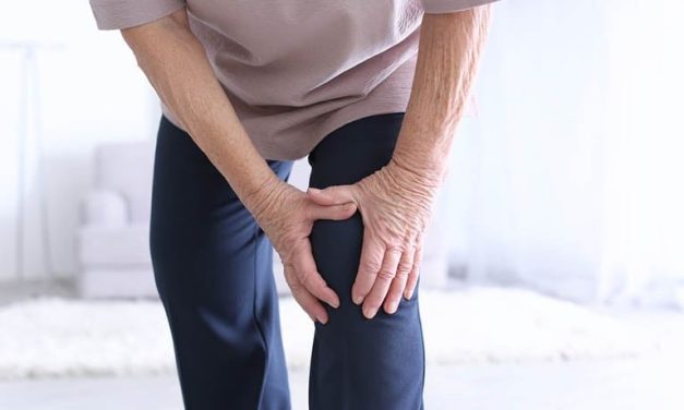 Prevalence of Arthritis in U.S. Adults 18.9 Percent in 2022