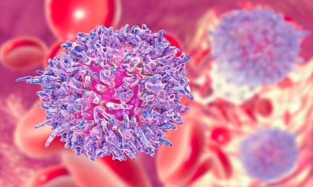 FDA Approves First CAR T-Cell Therapy for Adults With Leukemia or Lymphoma