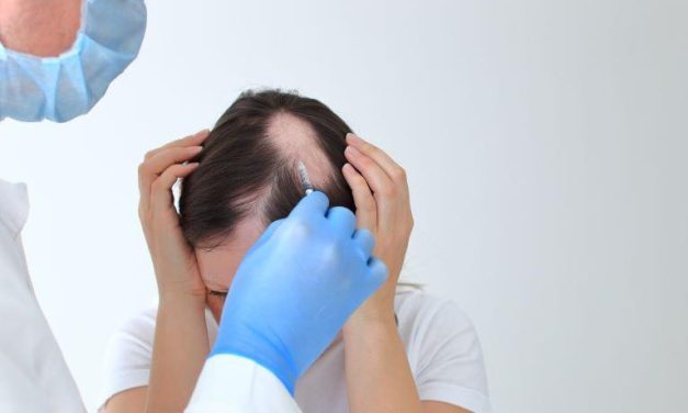 AAD: Continuous Improvements Seen Through 68 Weeks for Deuruxolitinib in Alopecia