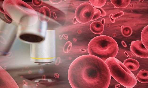 Iptacopan Improves Hematologic, Clinical Outcomes in Persistent Anemia