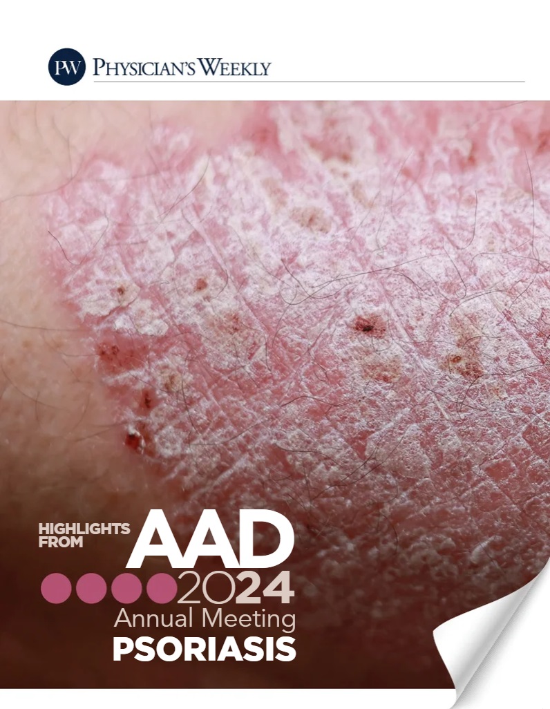 AAD 2024 eBook on Psoriasis