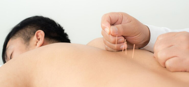 Evaluating the Accuracy of YouTube Information on Acupuncture for Managing Chronic Pain