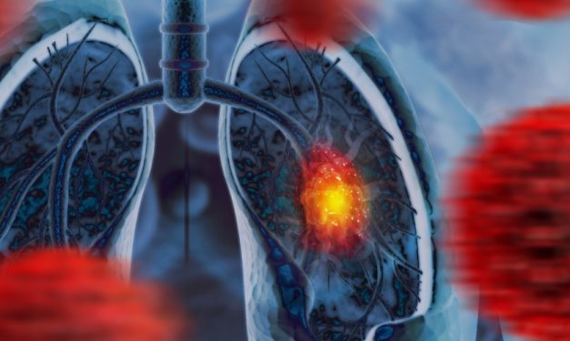 Thoracoscopic Lobectomy Superior to Open Surgery for NSCLC After Neoadjuvant Therapy