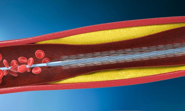 FFR-Guided Complete Percutaneous Coronary Intervention Is Non-Superior to Culprit-Only Percutaneous Coronary Intervention