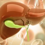 High Immunoscore Indicates Improved Survival in Biliary Tract Cancer