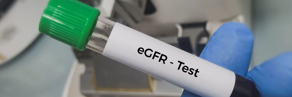 Blood sample for eGFR (Estimated glomerular filtration rate) test for diagnosis of renal or kidney disease.