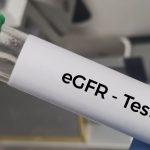 Blood sample for eGFR (Estimated glomerular filtration rate) test for diagnosis of renal or kidney disease.