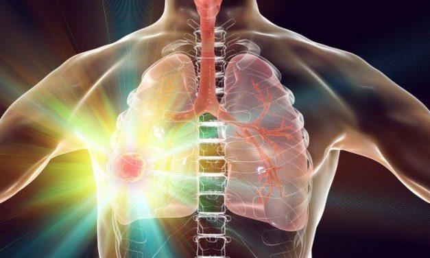 Alecensa Approved as First and Only ALK Inhibitor for Non-Small Cell Lung Cancer