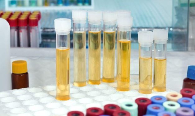 New Prostate Cancer Urine Test Has High Diagnostic Accuracy