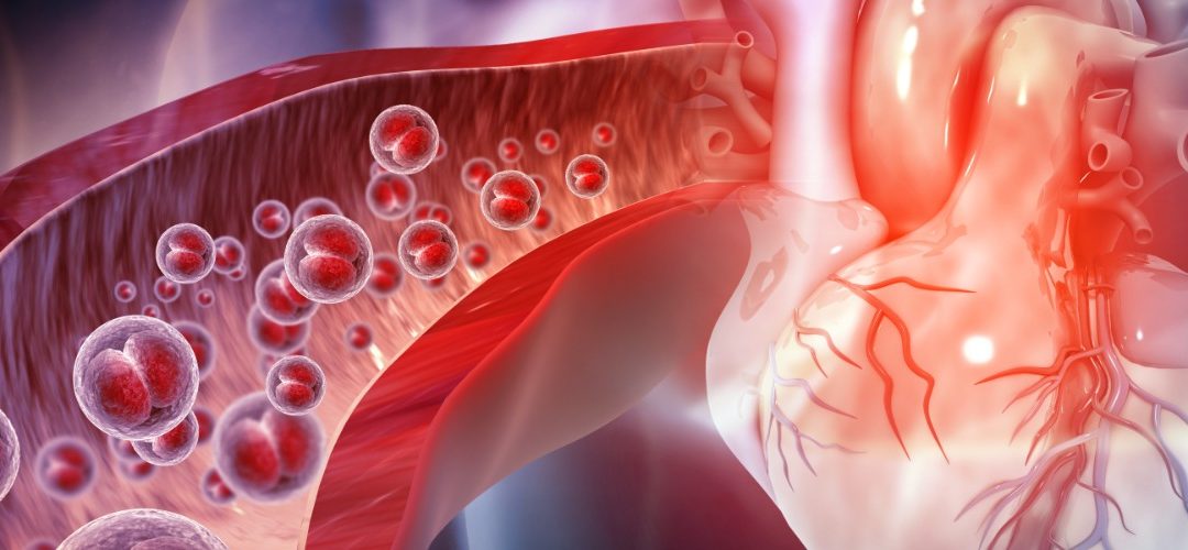 Early Warning Signs for Prevention and Treatment of Atherosclerotic Cardiovascular Disease