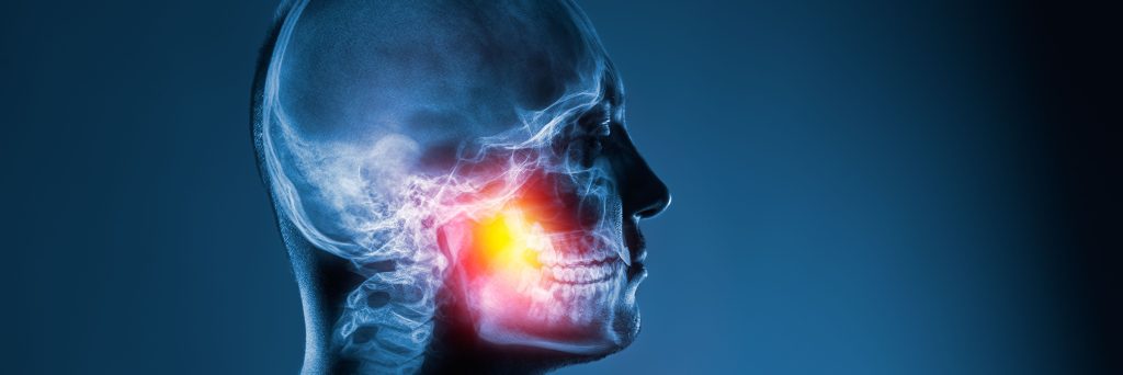 X-ray of a man's head on blue background. Medical examination of head injuries. Jaw joint, jaw pain, facial pain, oral pain