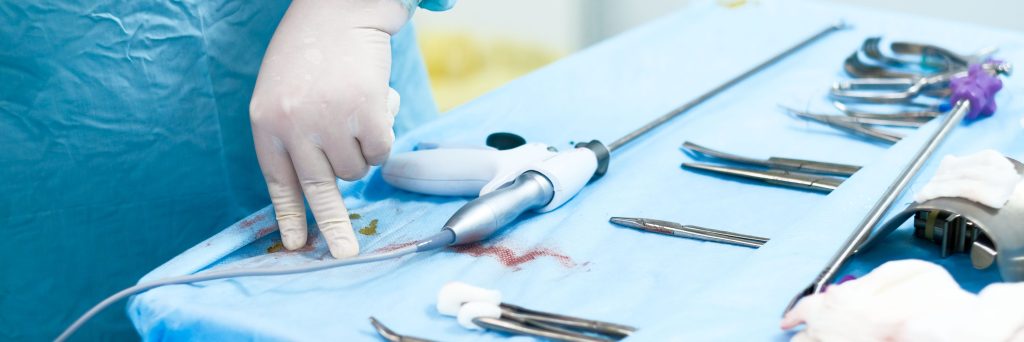 Selective focus on the hand of a surgeon wearing a sterile glove. Sterilized surgical instruments on the table in the operating room. Surgical laparoscopic equipment. Laproscopy