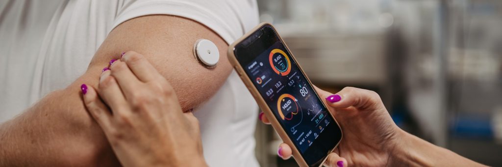 Doctor connecting continuous glucose monitor with smartphone, to check blood sugar level in real time. Obese, overweight man is at risk of developing type 2 diabetes, T2D, T2DM