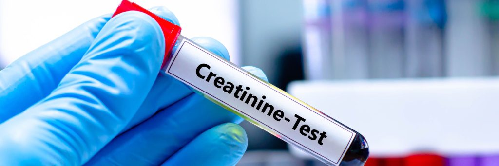 Blood sampling tube for creatinine test analysis.