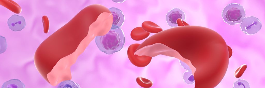 Hemolytic anemia is a sub-type of anemia, a common blood disorder that occurs when the body has fewer red blood cells