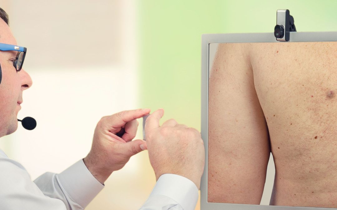 Teledermatology Comparable to In-Person Care for Diagnosing Nonmelanoma Lesions