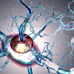 Late-Onset MS, LOMS, MS, multiple sclerosis, nerve cells, concept for neurodegenerative and neurological disease, tumors, brain surgery