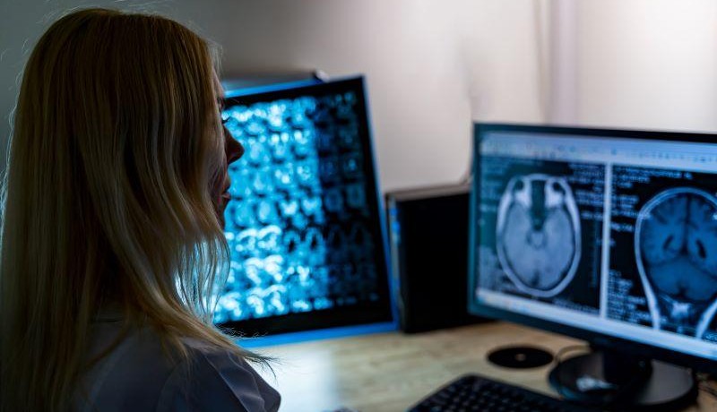 GPT IDs Errors in Reports With Same Accuracy as Radiologists