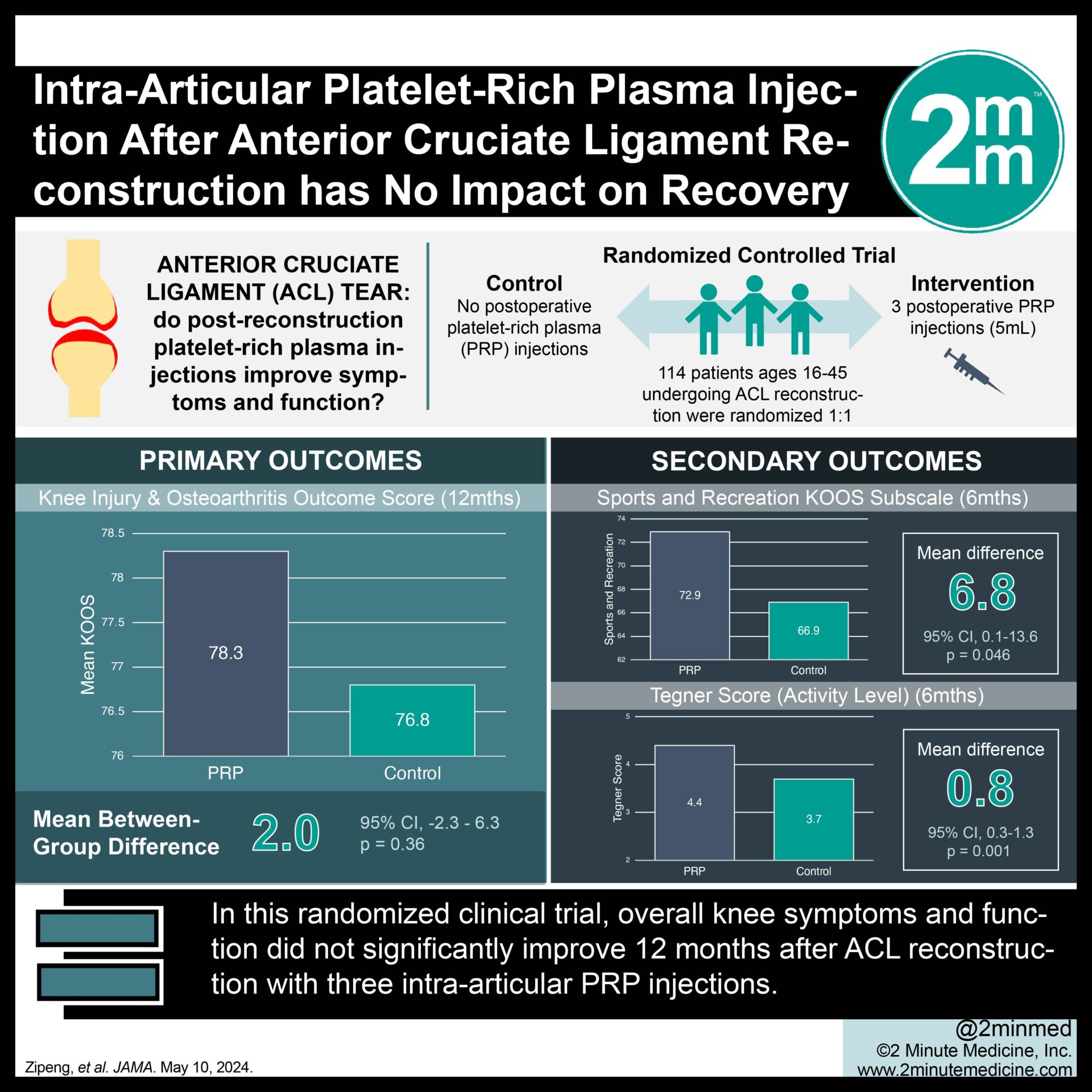 #VisualAbstract: Intra-Articular Platelet-Rich Plasma Injection After Anterior Cruciate Ligament Reconstruction has No Impact on Recovery