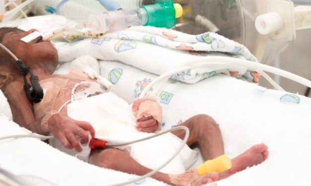 Post-PDA Ligation NAVA Bests SIMV for Favorable Outcomes in Infants Born Preterm