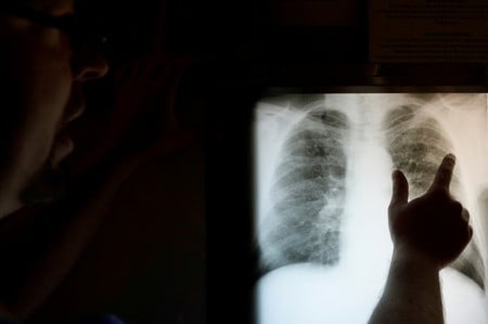 A tenth of U.S. veteran coal miners have black lung disease: NIOSH