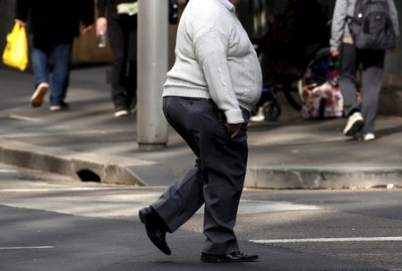 Type of weight loss surgery matters for people with severe obesity